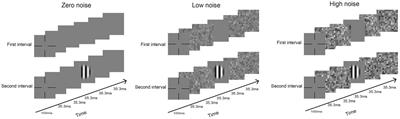 The effect of femtosecond laser-assisted in situ keratomileusis on contrast sensitivity
